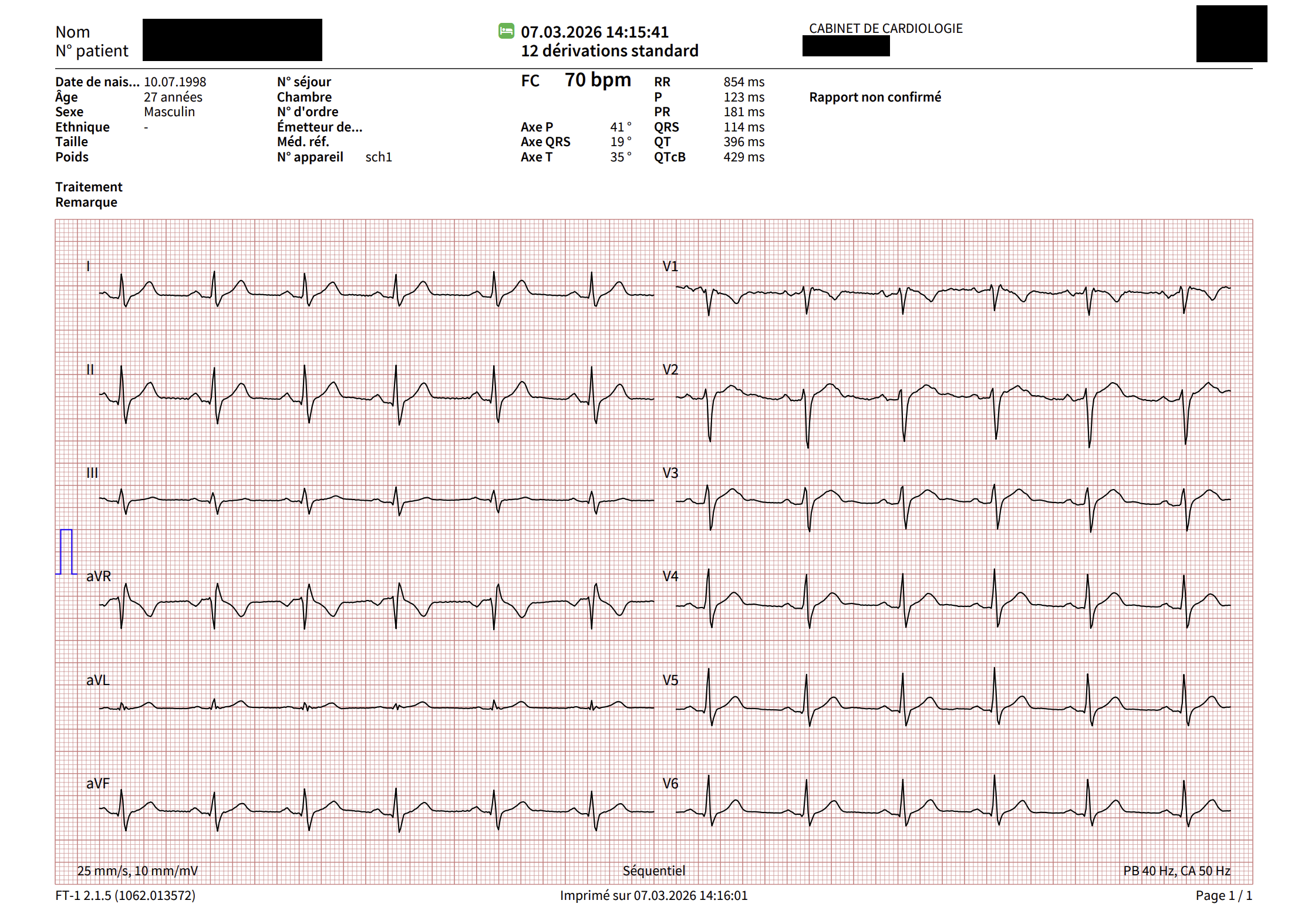 Rapport ECG revenu normal après électrisation sur chantier
